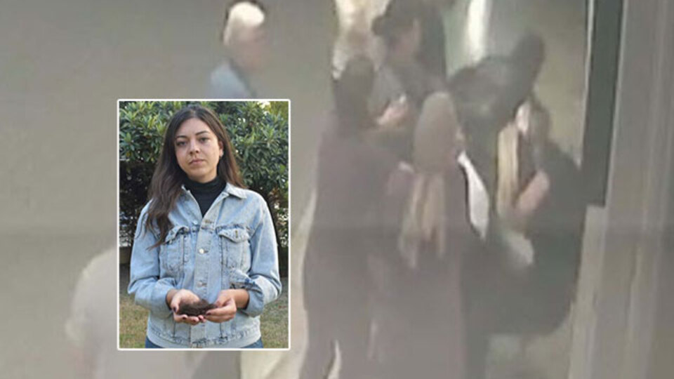 Dehşetin görüntüsü çıktı! Doktorun elinde bir tutam saçı kaldı!