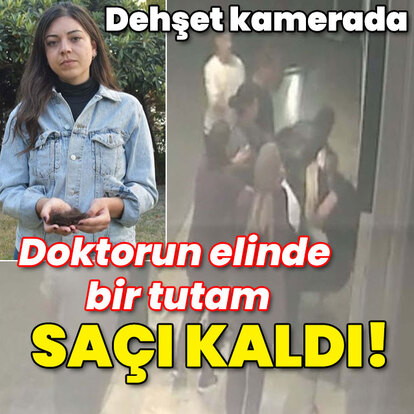 Dehşetin görüntüsü çıktı! Doktorun elinde bir tutam saçı kaldı!