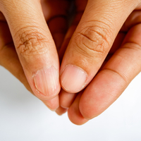 'Demir içeriği yüksek' yiyecekler listesi!