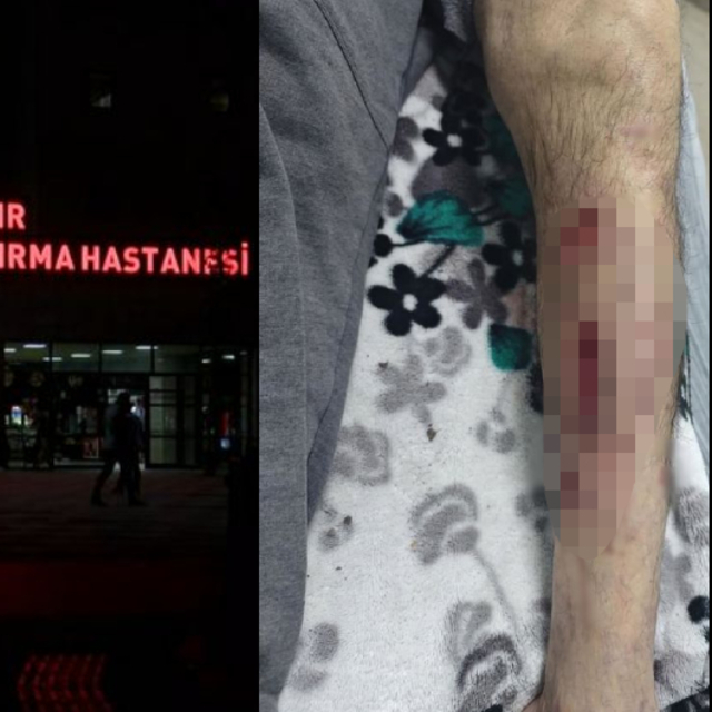 Köpek saldırdı, 25 dikiş atıldı