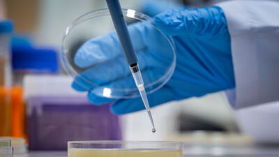 Yapay zeka iki günde çözdü