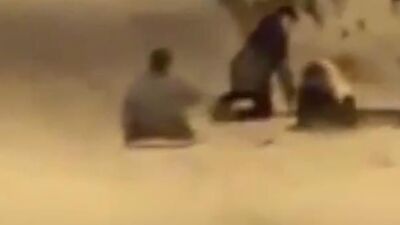 Tepsiyle kayan genç kız feci yaralandı!