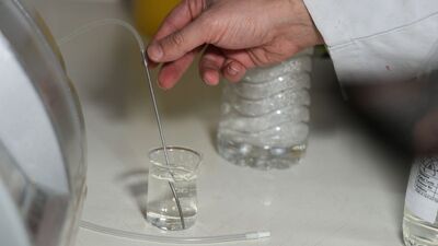 Sahte içkide 152 can kaybı!