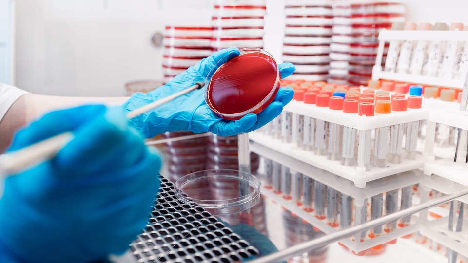 Menenjit vakalarındaki artış ürkütüyor