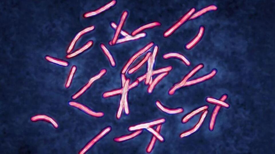 Yapay zeka bilim insanlarının yıllardır araştırdığı 'süper bakteri' sorununu iki günde çözdü