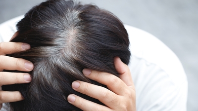 Erken yaşta saçlar neden beyazlar?