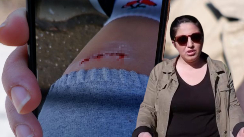 Edirne'de kadına köpek saldırdı