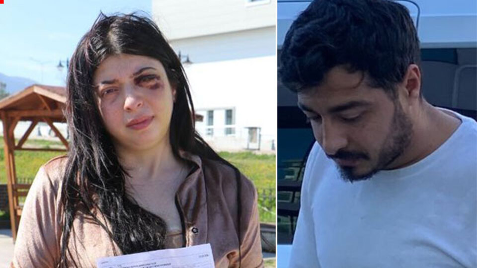 Önce taciz edildi! Sonra sokakta darp! Damla dehşeti yaşadı!