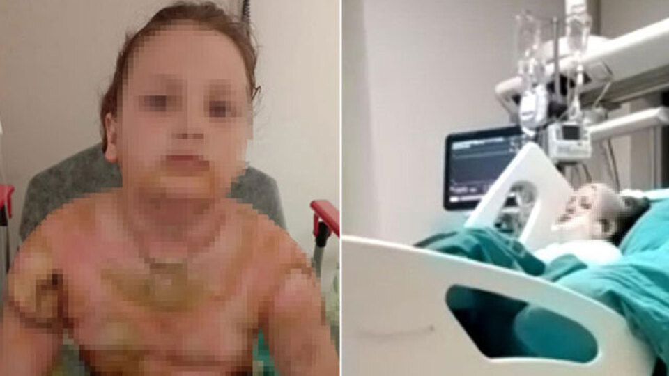 Sobalı okulda ısınan küçük kız yandı!