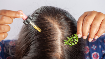 Kepeğe, yavaş uzayan saçlara son!