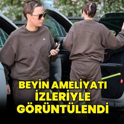 Beyin ameliyatı izleriyle görüntülendi