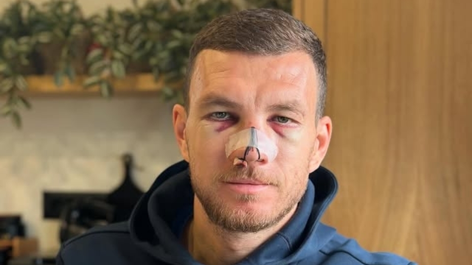 Edin Dzeko son halini paylaştı!