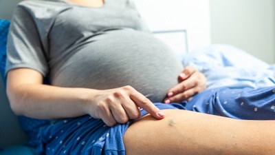 Gebelikte varis oluşumu bebeği etkiler mi?