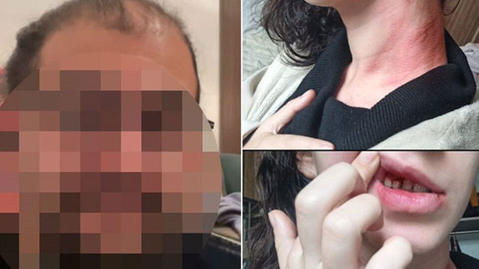 Genç kıza kafa atıp boğazını sıktı! Katil adayı komşu!