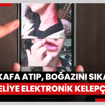 Parkta genç kıza kafa atıp, boğazını sıkan şüpheliye 3 ay sonra elektronik kelepçe