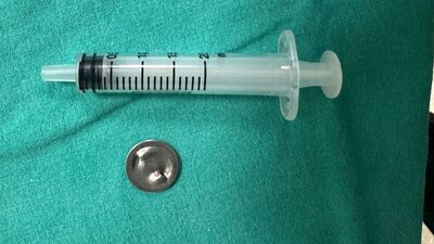 İki dudağının arasında tutarken yuttuğu metal pul akciğerinden çıktı