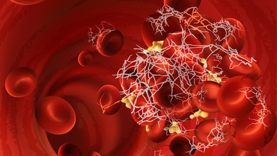 Pankreas kanserini atlattı, sıra karaciğerde