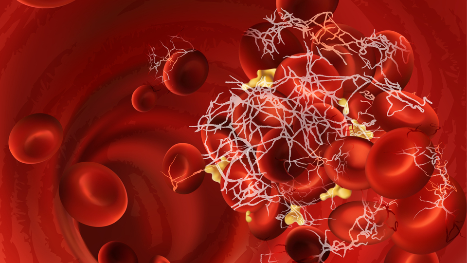 Pankreas kanserini atlattı, sıra karaciğerde