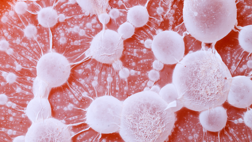 İşte kanserden korunmanın yolu...