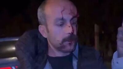 Avukatın darbedilmesine soruşturma