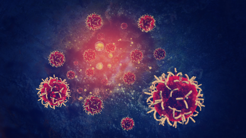 Yağlı diyet meme kanseri yayılmasını artırabilir