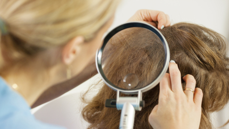 Saç biti nasıl temizlenir?