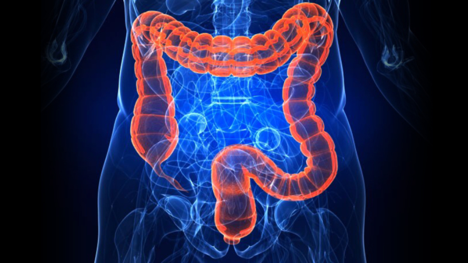 Kolon kanserini düşündüren 3 alarm belirtisi