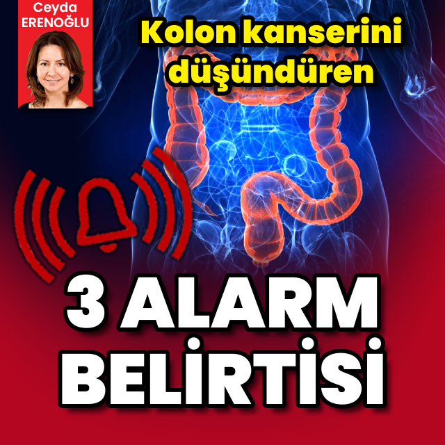 Kolon kanserini düşündüren 3 alarm belirtisi
