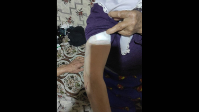 Yaşlı kadına sahipsiz köpekler saldırdı