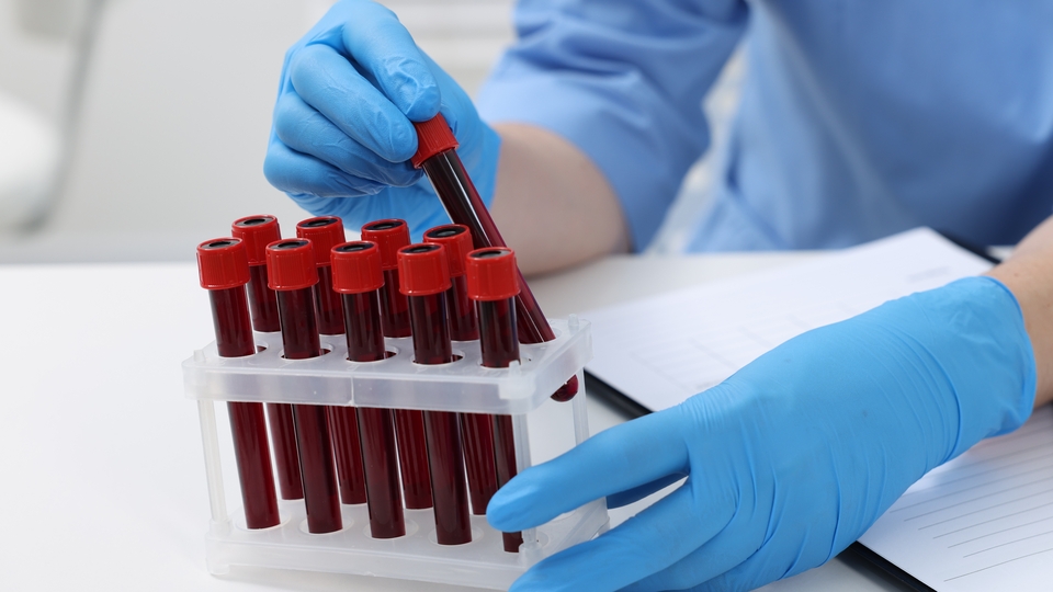 NHS: Kanseri tespit edebilen kan testini denemeye hazırız