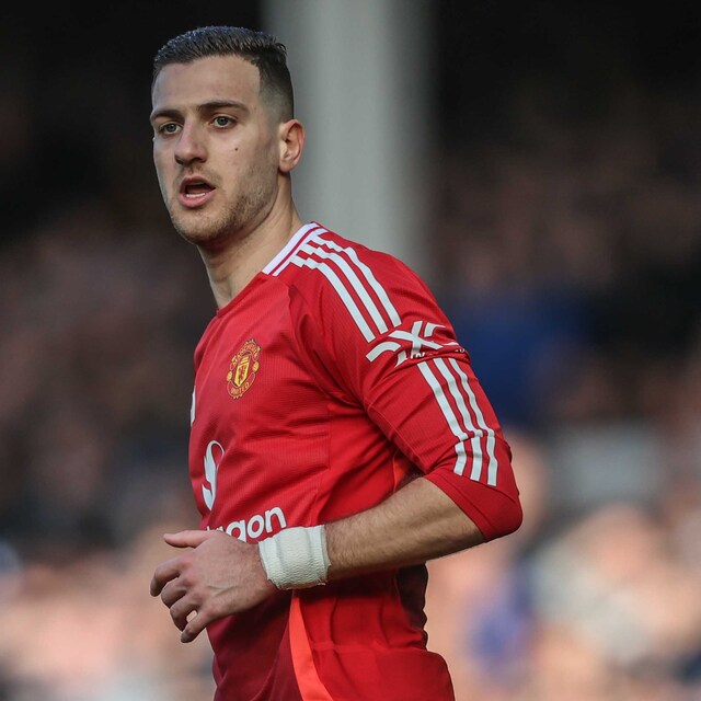 Manchester United'da sakatlık şoku!