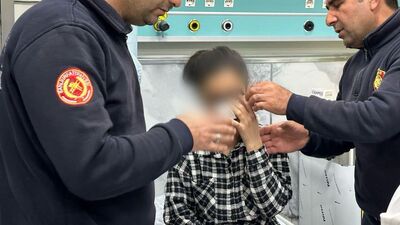 Fermuara gözünü sıkıştırdı