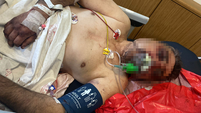 Öldüresiye saldırmış