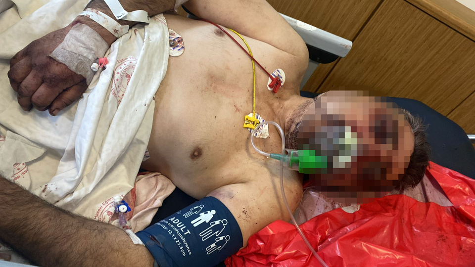 Öldüresiye saldırmış