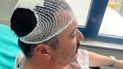 Makamında şekerlikle başına vurdu