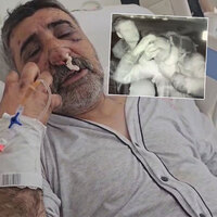 Taksici bayıltan şiddeti anlattı! "Gözlerimi oymaya çalıştı!"