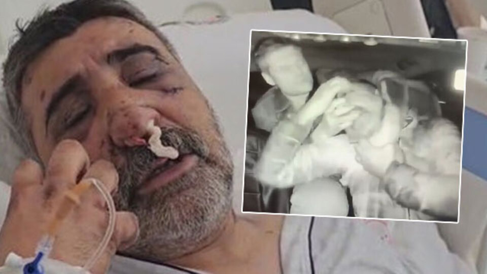 Taksici bayıltan şiddeti anlattı! "Gözlerimi oymaya çalıştı!"