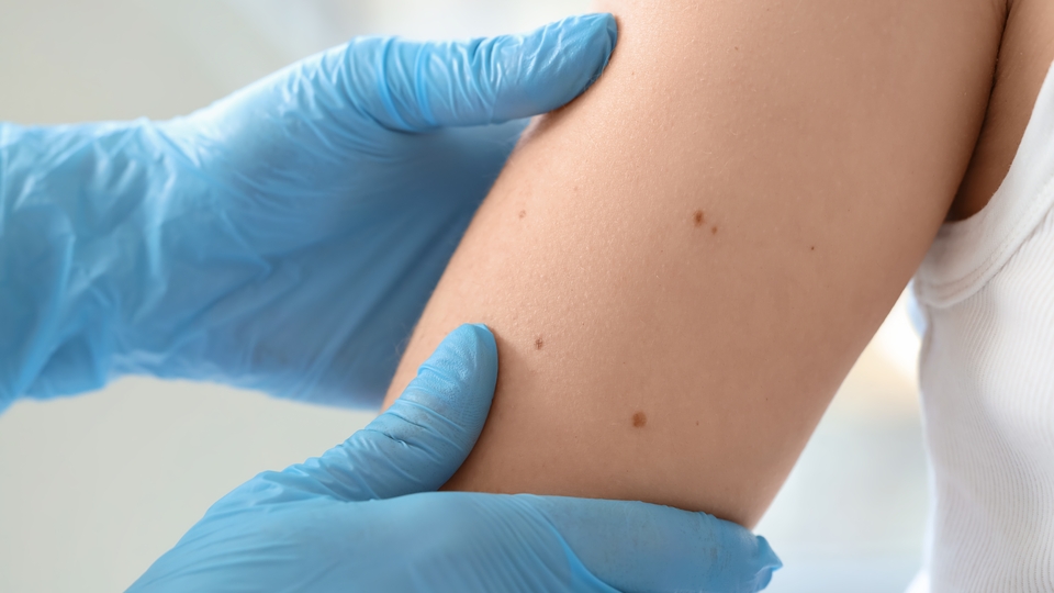 Benlerde şekil, renk değişimi varsa...