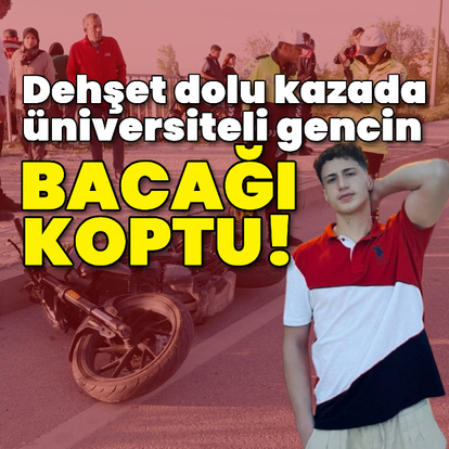 Dehşet dolu kazada üniversiteli gencin bacağı koptu!