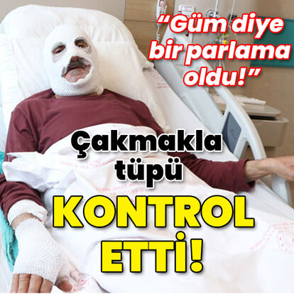 "Güm diye bir parlama oldu!" Çakmakla tüpü kontrol etti!