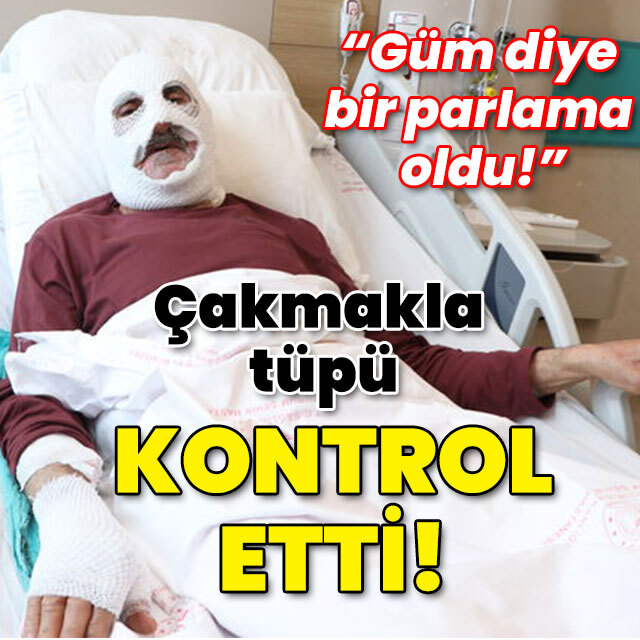 "Güm diye bir parlama oldu!" Çakmakla tüpü kontrol etti!