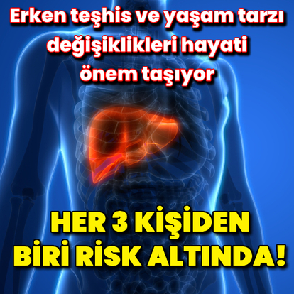 Her 3 kişiden birinin karaciğeri tehlikede olabilir!