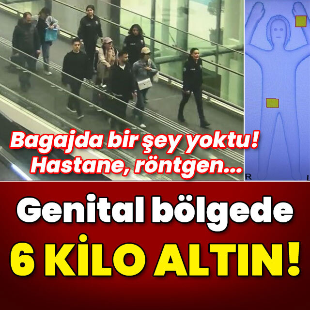 Hastanede röntgen çekildi! Genital bölgede 6 kilo altın!