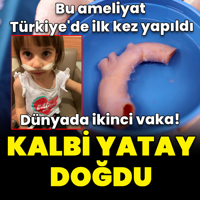 Kalbi 'yatay' doğdu, dünyada ikinci vaka!