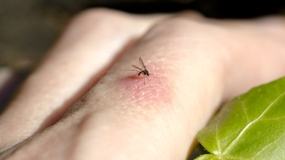 Kan grubunuz sinekleri size çekiyor olabilir!