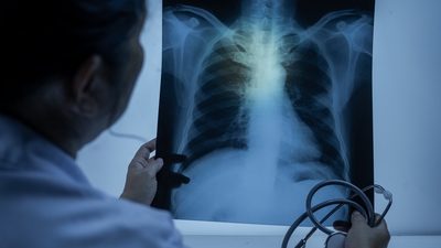 Prof. Dr. Özlü'den elektronik sigara uyarısı!