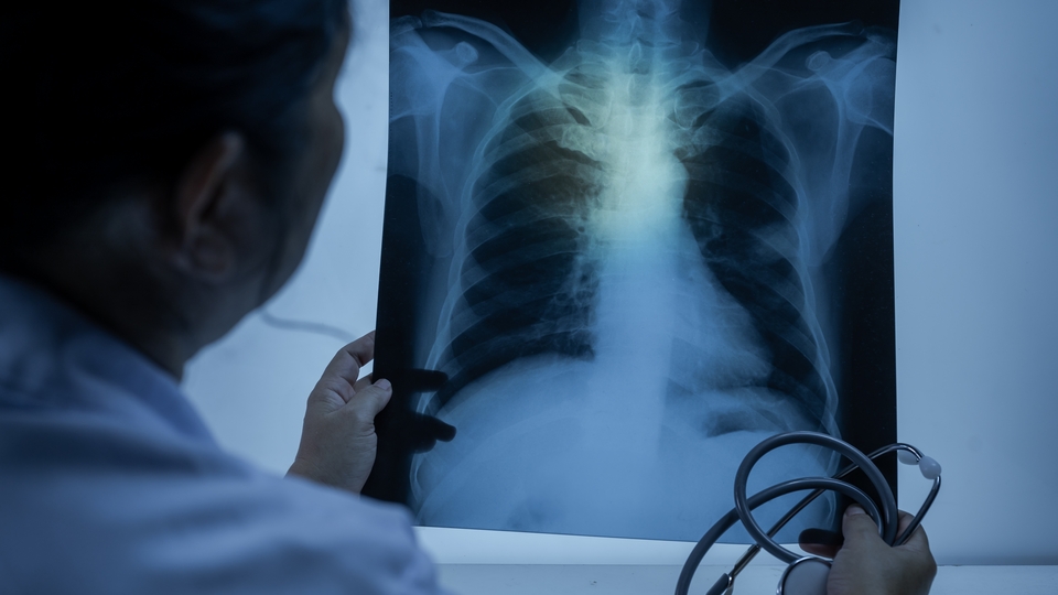 Prof. Dr. Özlü'den elektronik sigara uyarısı!