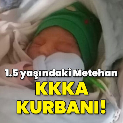 1.5 yaşındaki Metehan bebek KKKA kurbanı oldu!