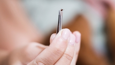 Kene uyarısı: Hastalık ölümcül olabilir