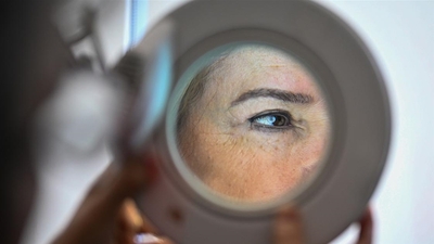 Araştırma: Melanom, kadınlarda ve erkeklerde farklı bölgelerde görülüyor